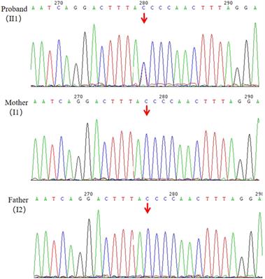 Case report: Whole exome sequencing reveals a novel splicing variant of ANKRD17 gene in a Chinese male juvenile with developmental delay and transient tic disorder